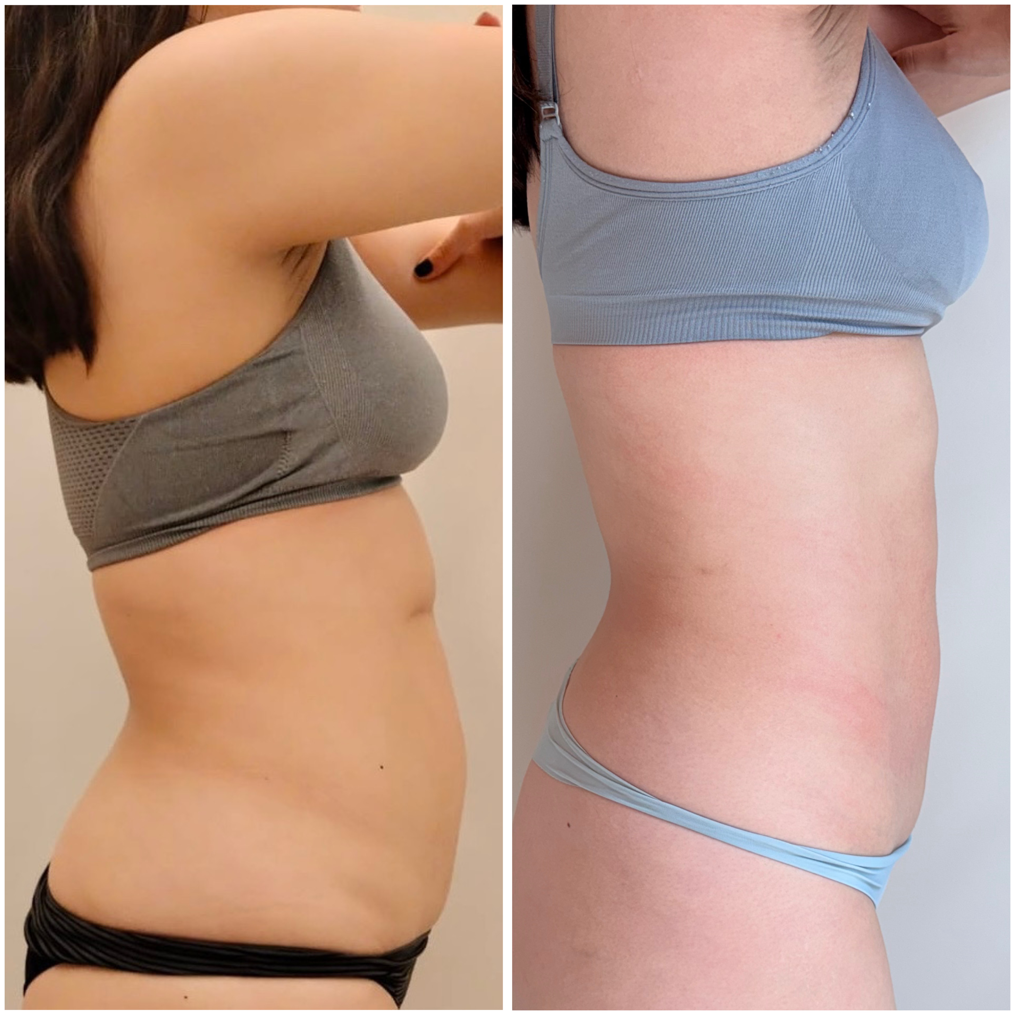 Body Reset Aitama