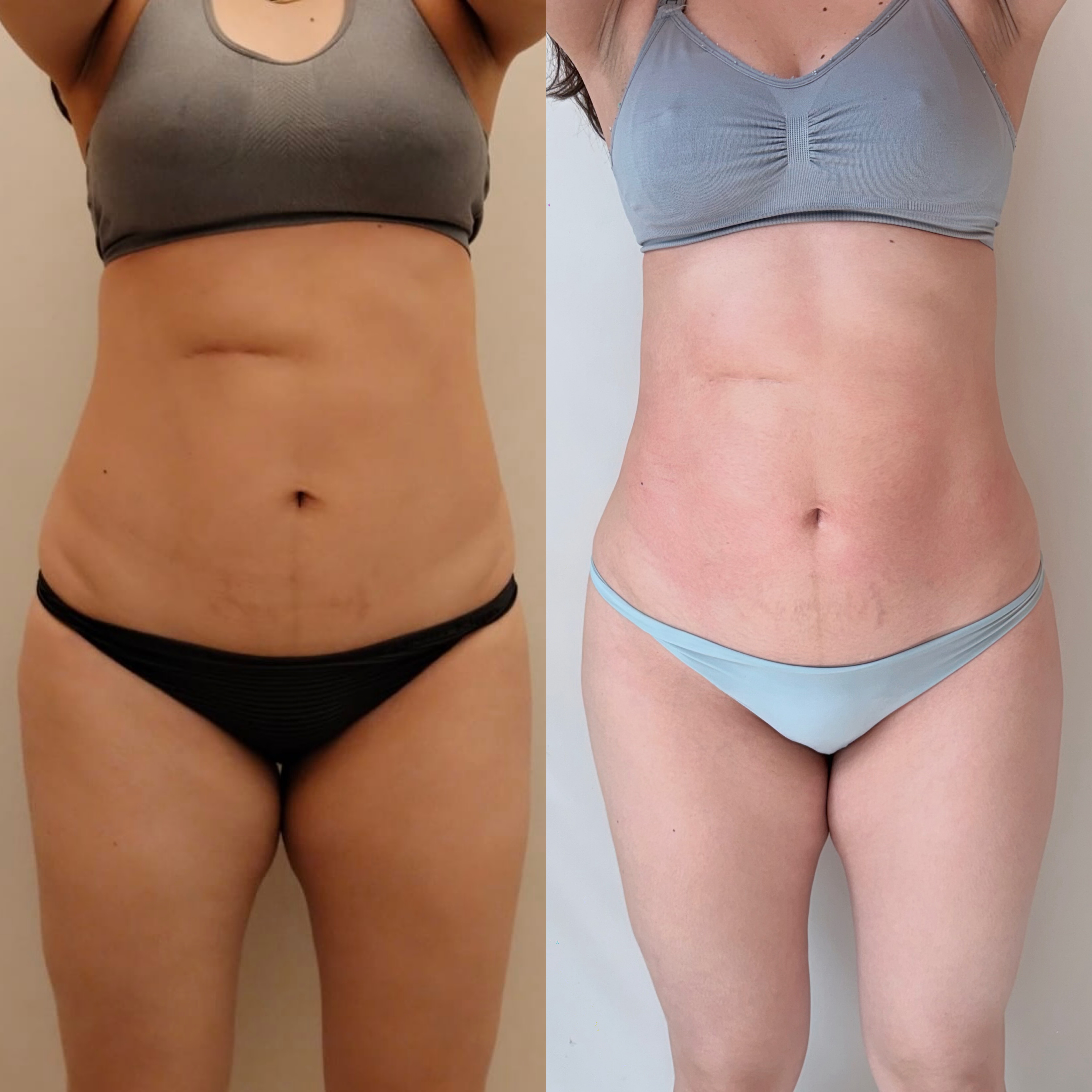 Body Reset Aitama